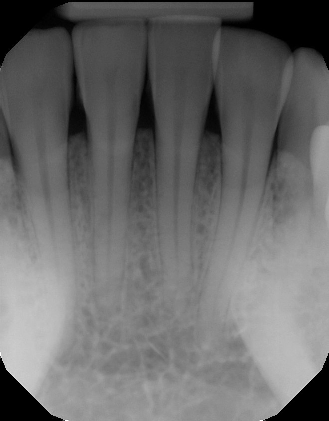 Dental X-ray of healthy teeth
