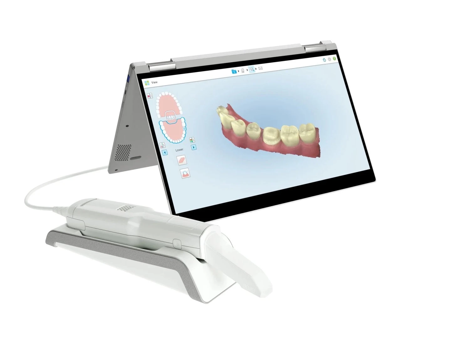 Intra-oral 3D dental scanner in use