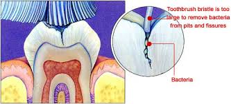 Cross section of a tooth