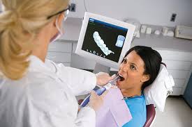 Digital impression scanner