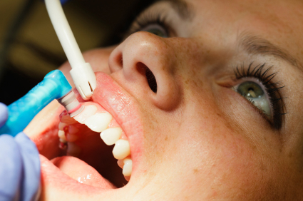 A dental hygienist cleaning a patient's teeth