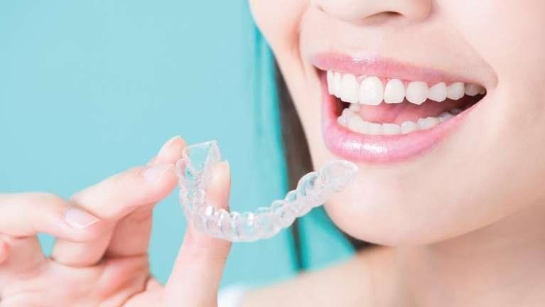 A clear Invisalign aligner tray being placed over teeth