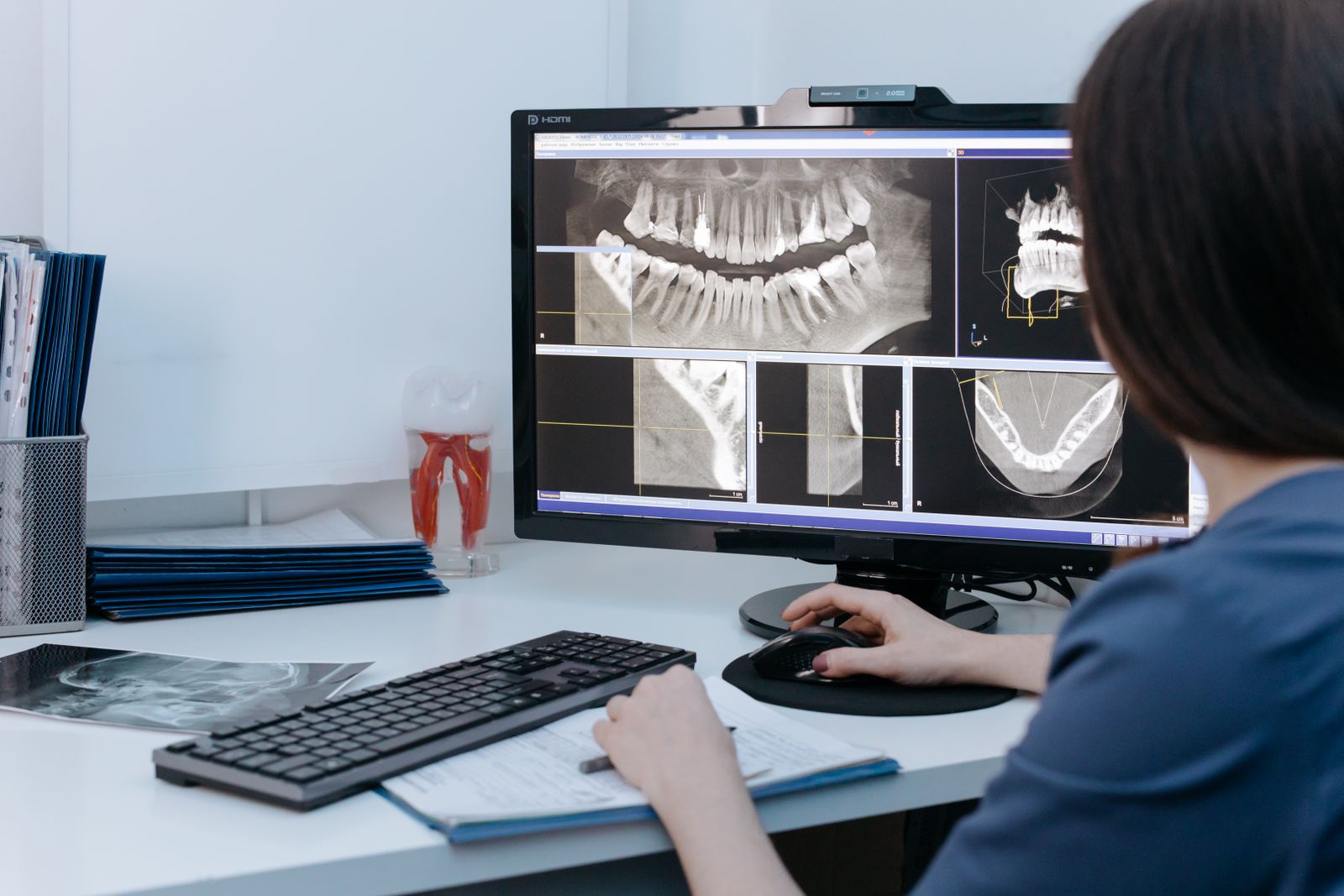 A dentist reviewing digital dental x-rays on a screen