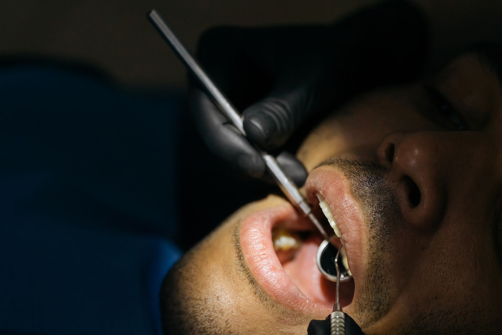 A close-up dental examination with precision instruments